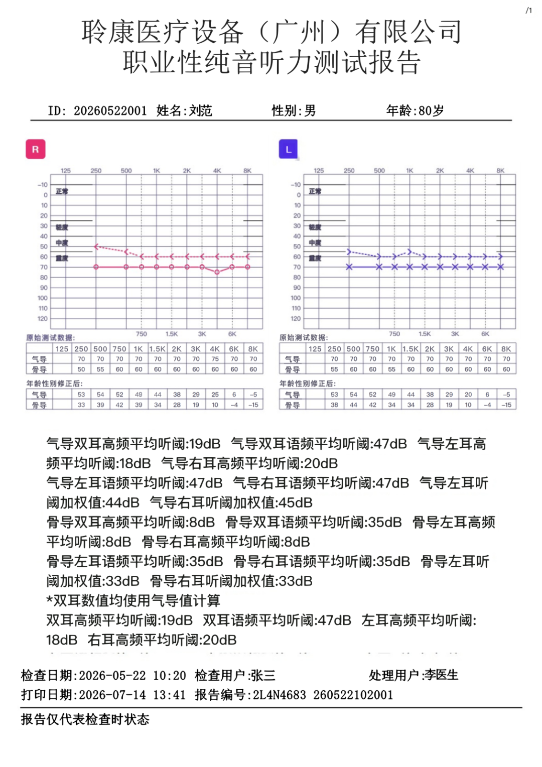 聆康纯音听力计|职业健康检查/职业病诊断核心优势(图3)