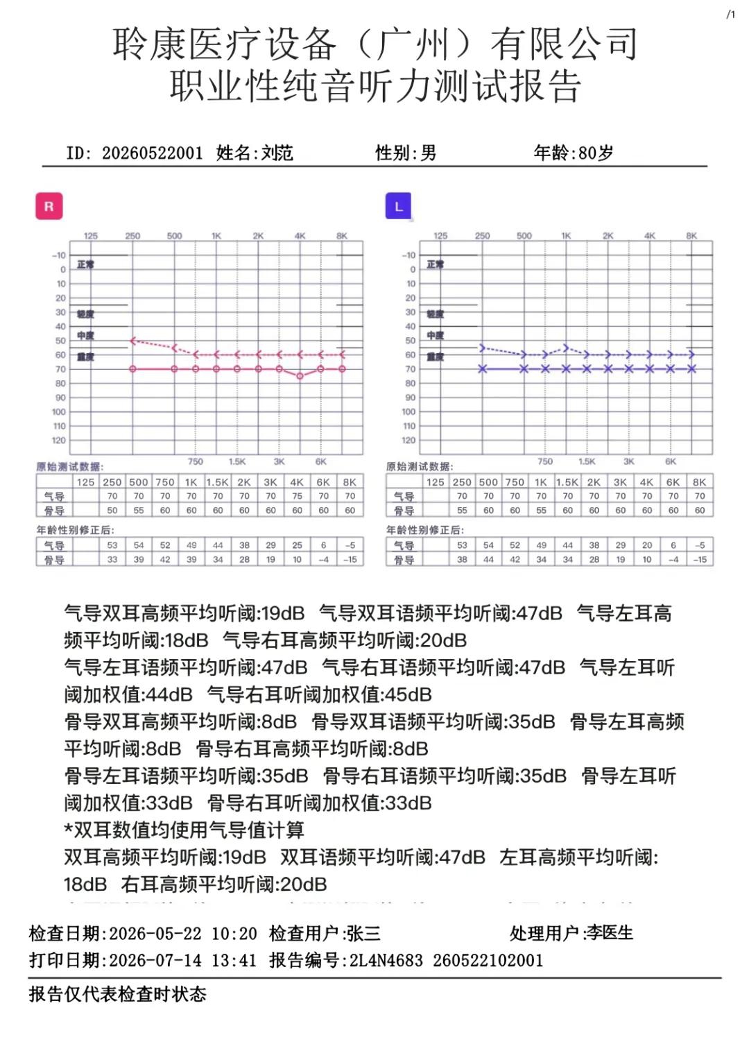 聆康纯音听力计|职业健康检查/职业病诊断核心优势(图3)