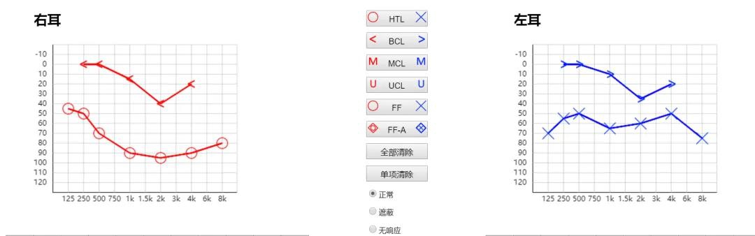 听管家|聆康·听觉有道全生命周期数字化听力健康管理平台(图5)